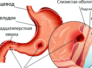 Полезно ли сдавать кровь? Польза донорства для организма женщины Вред от сдачи крови для доноров