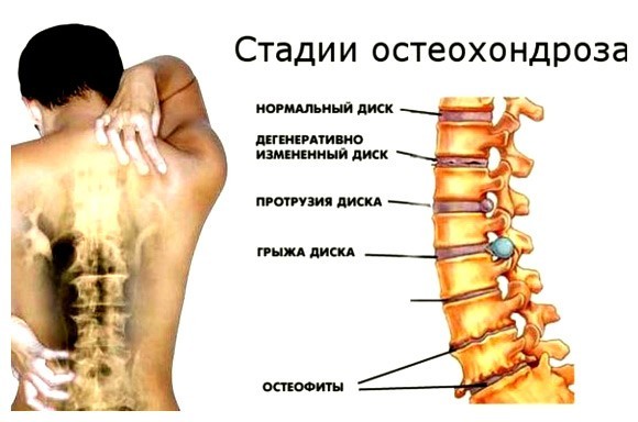 Что означает боль в грудине посередине