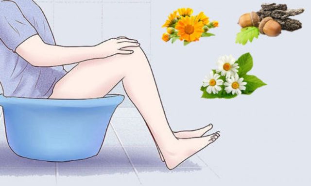 Народные способы лечения геморроя