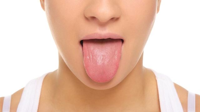 Трещины на языке посередине и белый налет: причины и лечение