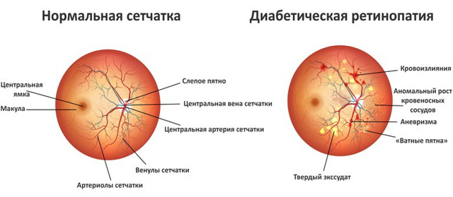 Капли в нос при сахарном диабете 2 типа — Всё про диабет