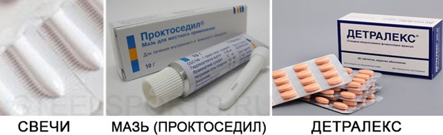 Можно ли приседать при геморрое - Лечение геморроя