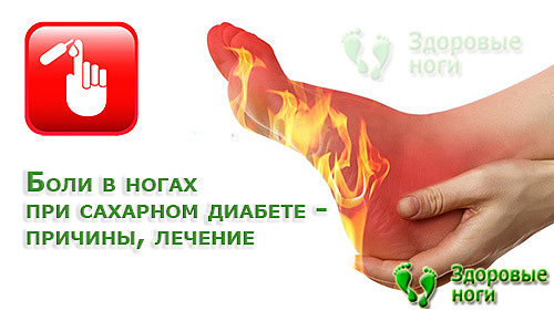 Боли в ногах при сахарном диабете - Здоровье людей