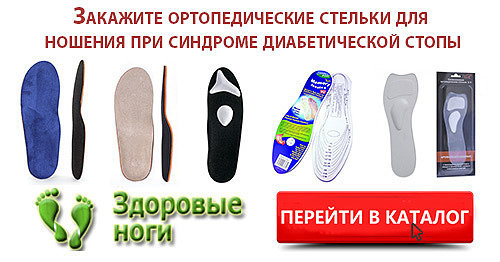 Отекают ноги при сахарном диабете - что делать?
