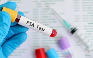 Анализ крови ПСА — что это такое? Расшифровка и норма