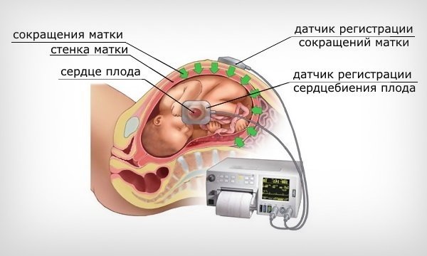 Сердцебиение плода по неделям