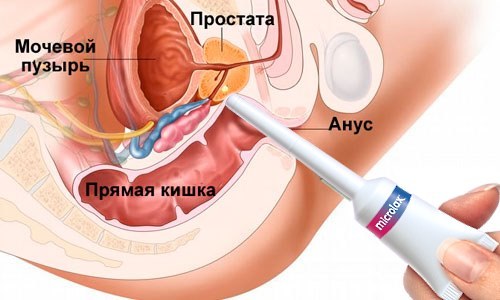 Как часто можно пить Микролакс? - Lucklady