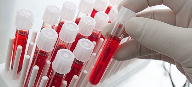 Плохая свертываемость крови при беременности чем грозит ребенку - Все про гипертонию