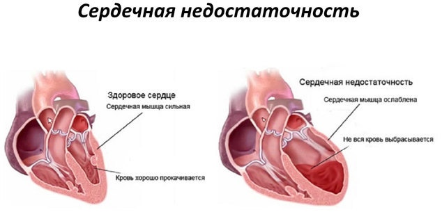 Строение сердца анатомия