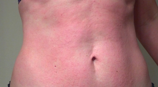 Стрезам: инструкция по применению и для чего он нужен, цена, отзывы, аналоги