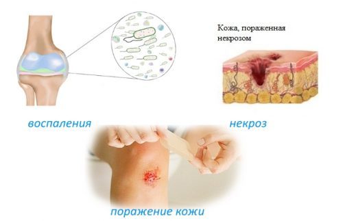 Инструкция по применению мази Хондроитин - показания