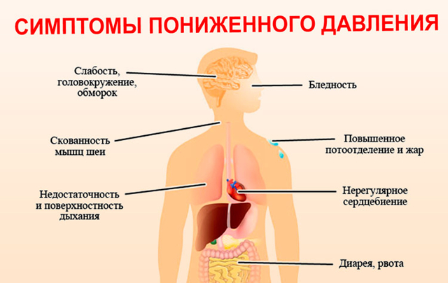 Гипотония - виды, признаки, лечение