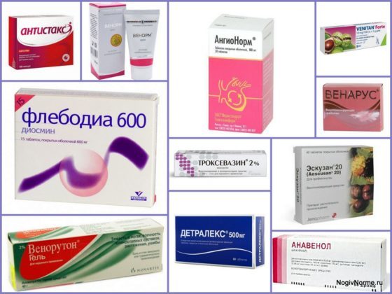 Венотоники при варикозе ног - гель, уколы, отзывы