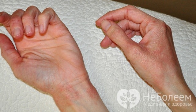 Симптомы и лечение аллергии на холод