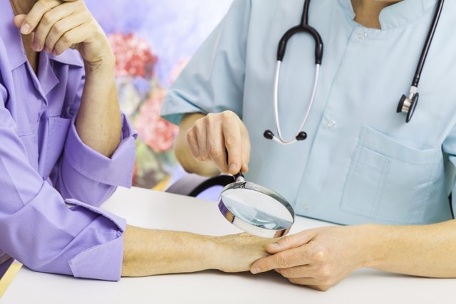 Лечение псориаз на руках - фото, симптомы, виды псориаза на руках