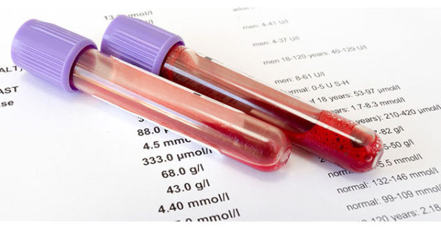 Что такое АЛТ в биохимическом анализе крови