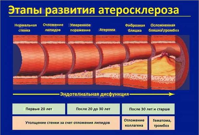 Почему появляется гипоплазия головного мозга