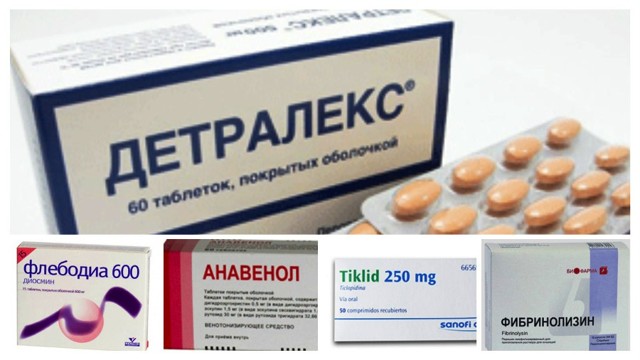 Кдо что это такое | Все о ретикулярном варикозе
