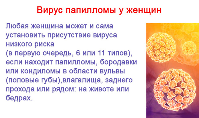 Вирус папилломы человека у женщин симптомы фото