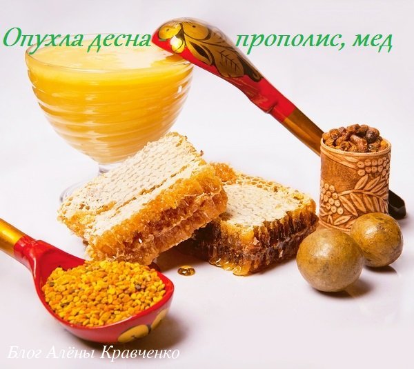 Красные Десна Вокруг Зуба и Болит Что Делать, Как Избавится?