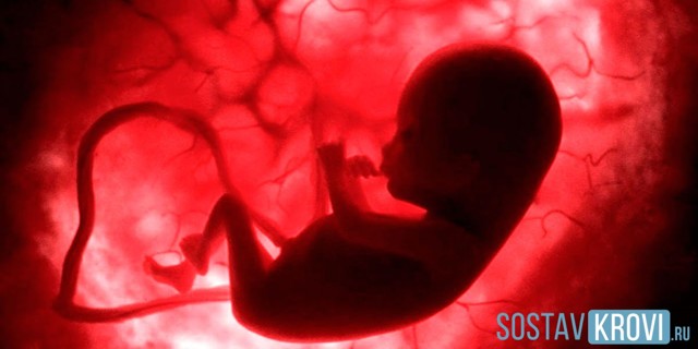 Киста сосудистого сплетения головного мозга: возникновение, диагностика, лечение. Опасна ли киста сосудистого сплетения для новорожденного?