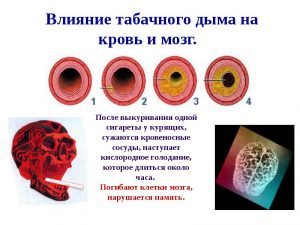 Можно ли пить алкоголь при атеросклерозе? - Диабет - 100 бед