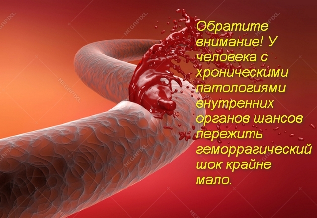 Геморрагический шок: неотложная помощь и стадии