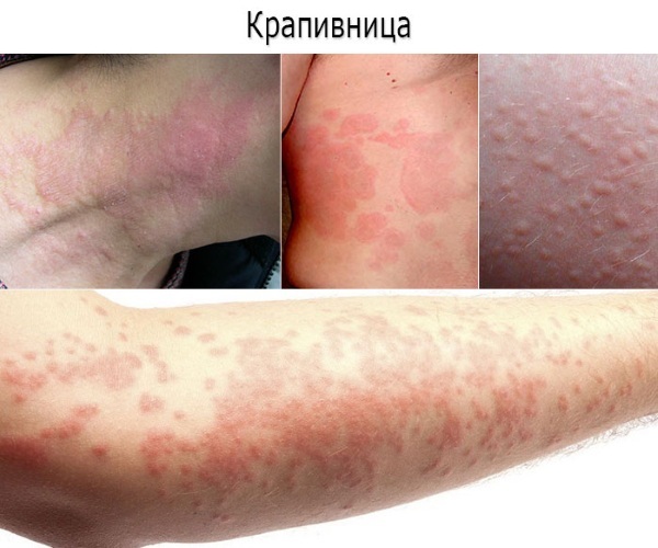 Флеминга мазь цена, Флеминга мазь купить, инструкция по применению, аналоги в Лаборатории Красоты и Здоровья