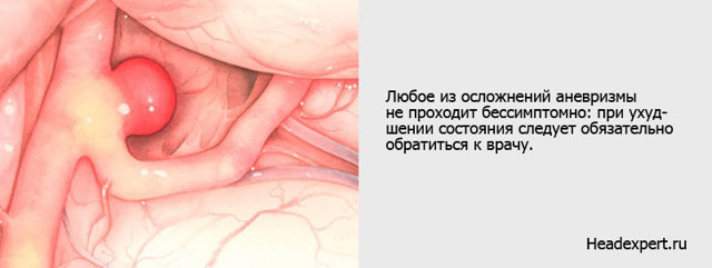 Аневризма головного мозга: что такое, почему возникает, группы риска, классификация, симптомы, осложнения, последствия, диагностика, лечение