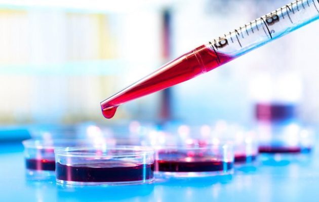 Повышены моноциты у взрослого: причины