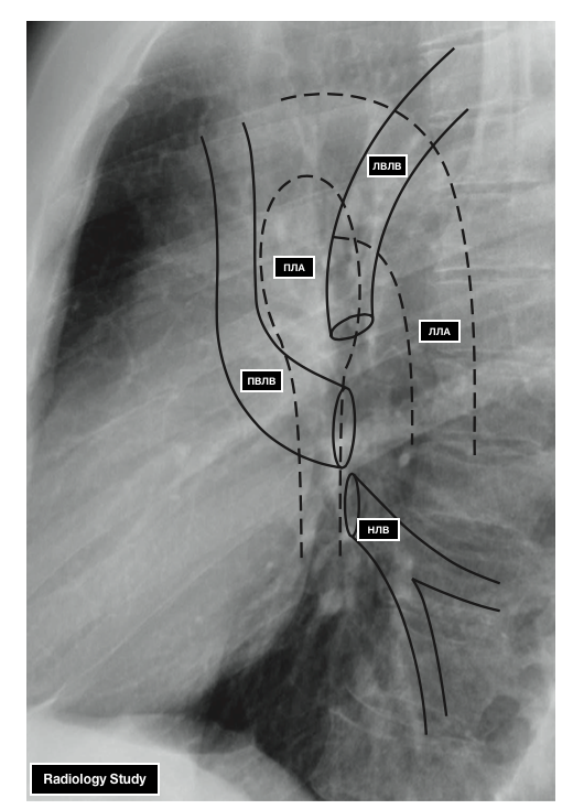 Анатомия сосудов легких. Легочная артерия