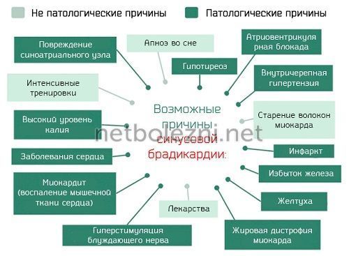 Брадикардия симптомы и лечение, какие таблетки принимать?