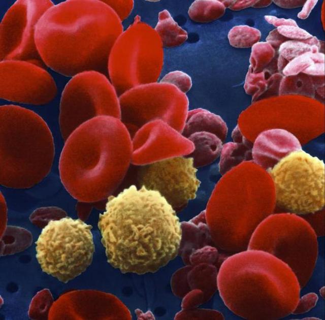 Совместимость крови для зачатия ребенка – таблица совместимости групп крови и резус факторов для зачатия