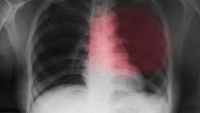 Сильное сердцебиение: причины, что делать