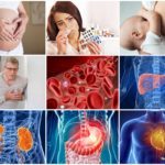 Препараты и народные средства для разжижения крови при варикозе