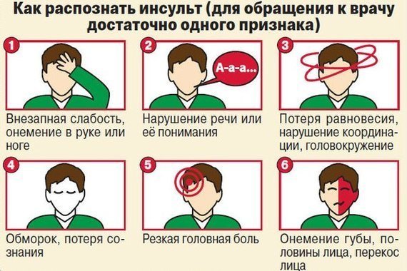 Ишемический инсульт - причины, симптомы, диагностика и лечение
