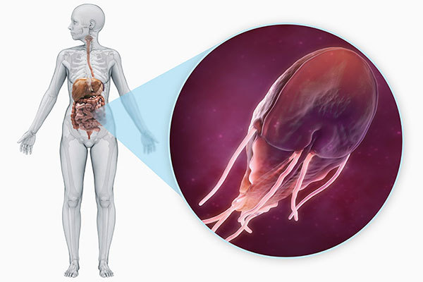Лечение лямблиоза у взрослых медикаментозными средствами. Детальные схемы лечения и дозировка препаратов. Лямблии у взрослых: симптомы и лечение 18964 0