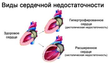 Высокий пульс при нормальном давлении что делать