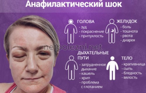 Низкое давление - причины, симптомы и признаки пониженного давления