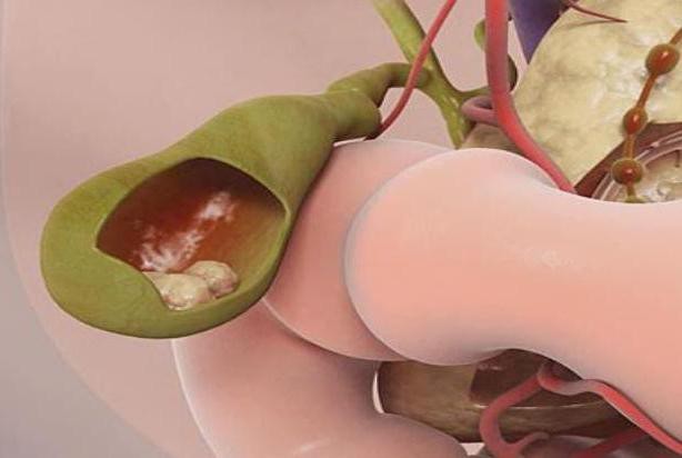 Холагол - инструкция по применению, цена и аналоги