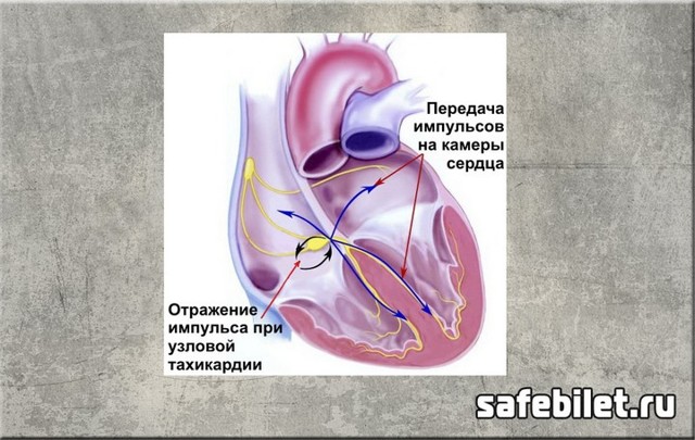Берут ли в армию с тахикардией в 2019 году?