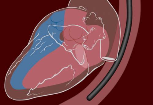 Эхо КГ сердца что это такое, как делают