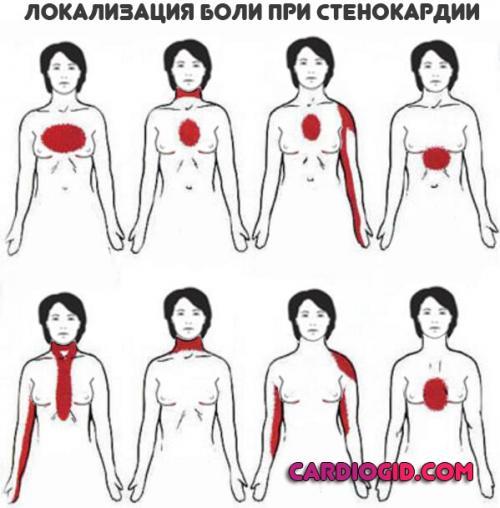 Ноющая боль в области сердца: причины и лечение