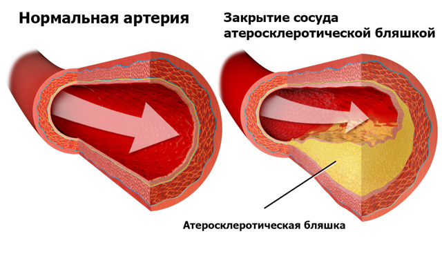 Как принимать Тромбоасс для разжижения крови: инструкция