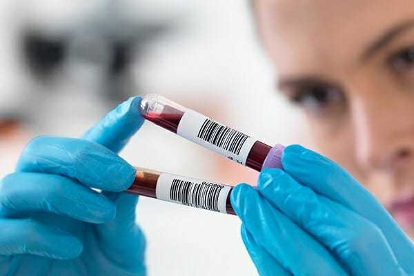 Гормон ФСГ в крови - Повышенный гормон ФСГ у женщин в лаборатории Lab4U