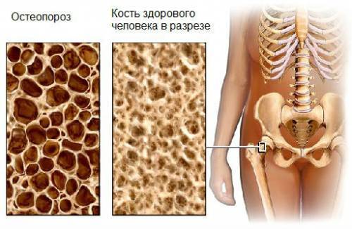 Ионизированный кальций в крови: норма анализа, причины повышения, понижения