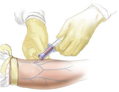 Гормон ФСГ в крови - Повышенный гормон ФСГ у женщин в лаборатории Lab4U