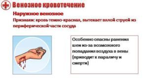 Большая энциклопедия нефти и газа. Признаки артериального кровотечения и венозного.