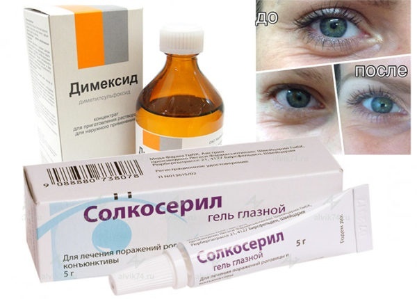 Гель Солкосерил для глаз и от морщин: инструкция по применению и отзывы