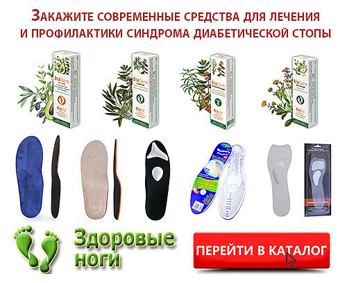 Отекают ноги при сахарном диабете - что делать?